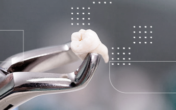 Cirurgia de terceiro molar (siso)