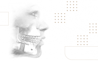 Cirurgia buco maxilo facial